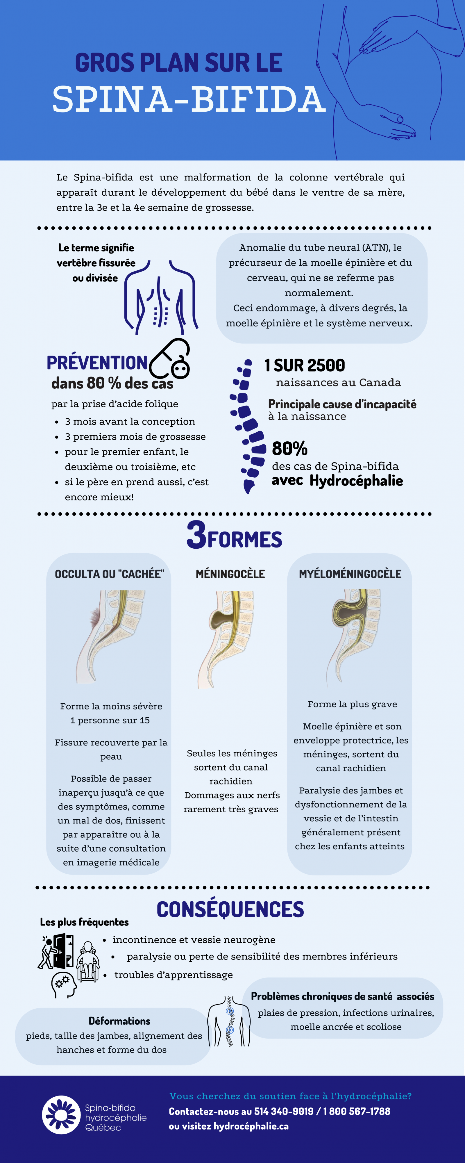 Synthèse sur le spina-bifida et ses trois formes