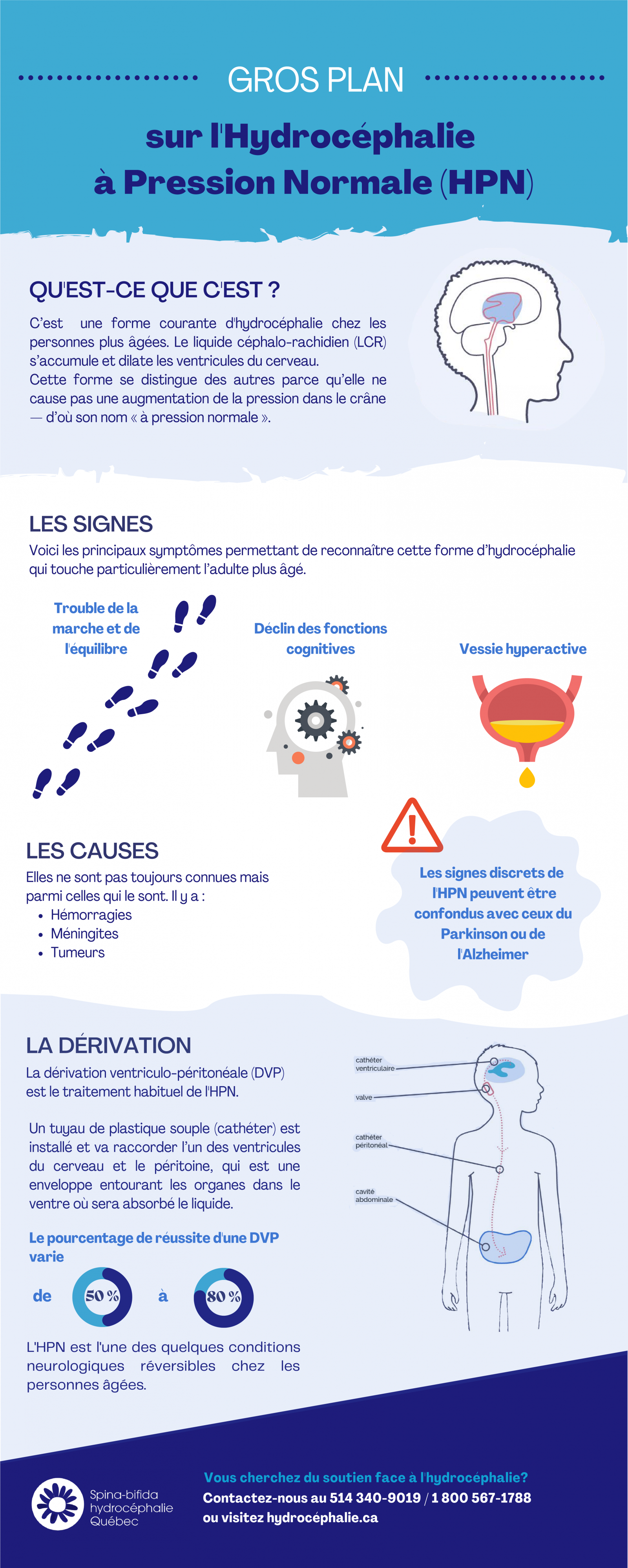 Synthèse sur l'Hydrocéphalie à Pression Normale (HPN)