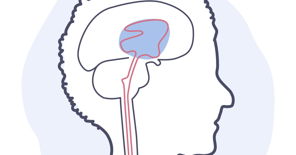 Hydrocéphalie à pression normale (HPN) Hydrocéphalie